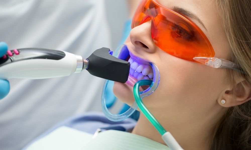 Diş Beyazlatma