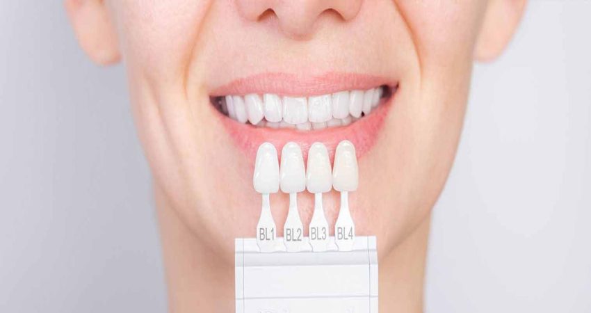 Zirkonyum Kaplama Nasıl Yapılır